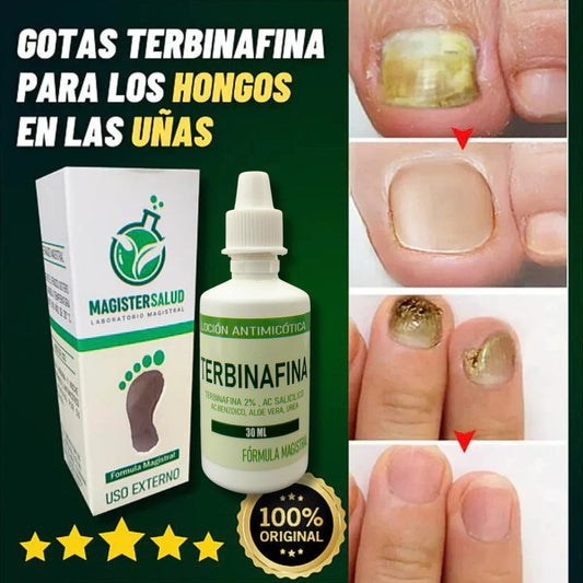 ADIOS HONGOS DE LAS UÑAS - Terbinafina HerbalNails™