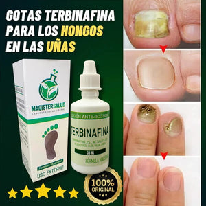 ADIOS HONGOS DE LAS UÑAS - Terbinafina HerbalNails™