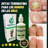 ADIOS HONGOS DE LAS UÑAS - Terbinafina HerbalNails™